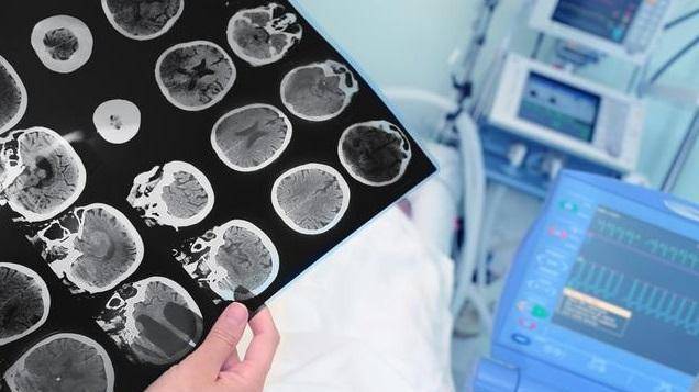 脑胶质瘤新纪元,重塑生活的自信与成就感的力量学习之路