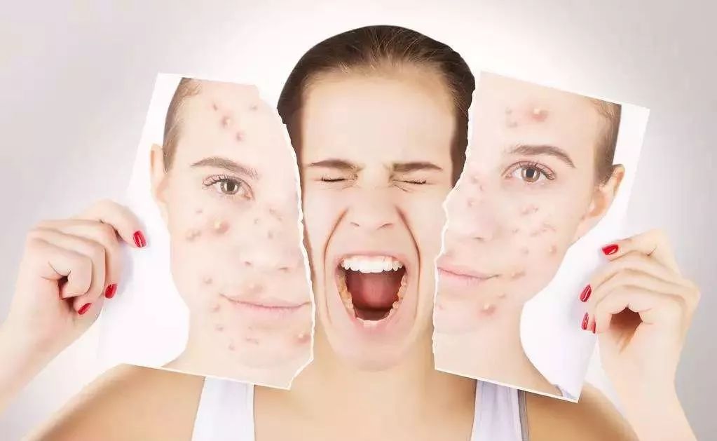 失禁性皮炎最新分期及革命性智能护理产品重塑生活，科技引领未来新篇章