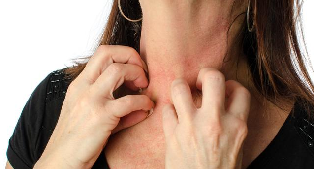 为什么总是突发皮炎：突然皮炎是什么征兆 