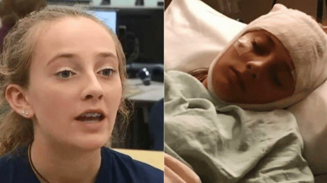 突发罕见失忆症：突然失忆症 