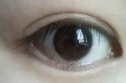 眼睛不断流泪是什么缘故：眼睛不停的流泪怎么办 