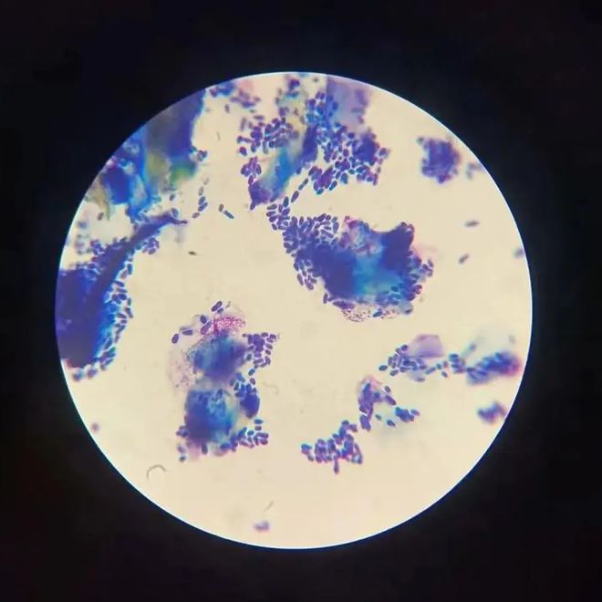 圆圈形状不断扩大的物品：圆形的拓展 