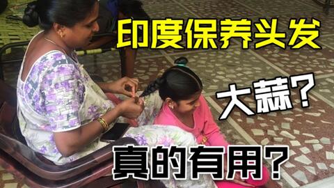 如何高效防秃顶：防秃方法 