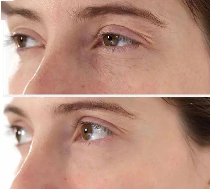 美颜霜宣传：美颜霜是什么? 