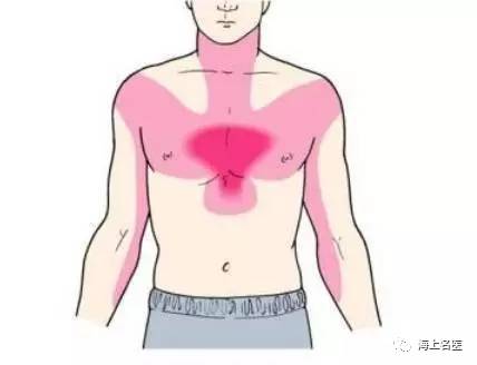 心口持续不断的疼一宿：心口不间断的疼 