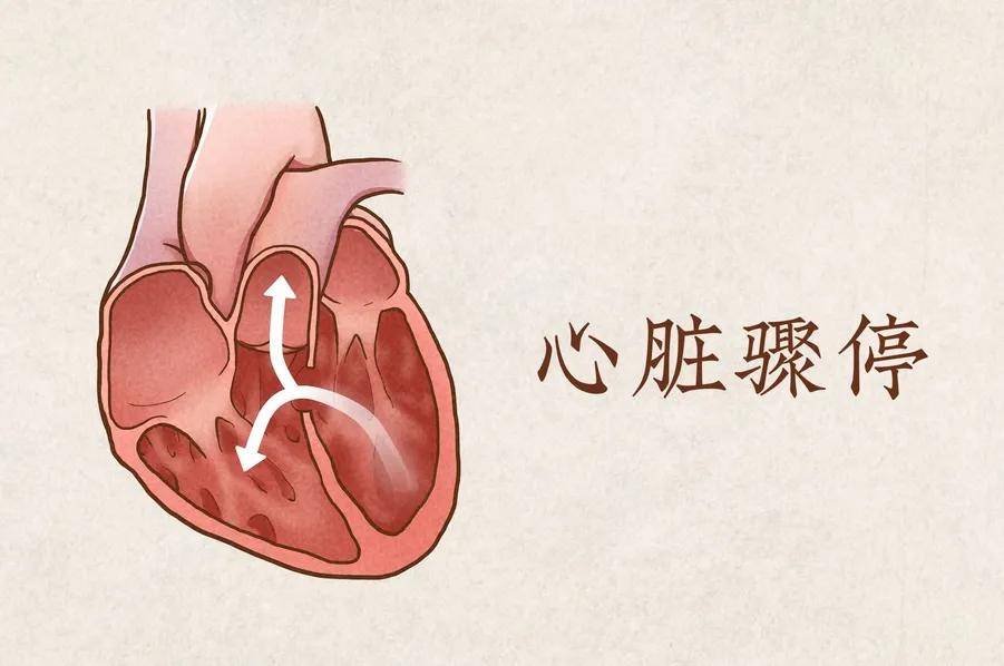 房颤突发性：突发房颤的急救措施 