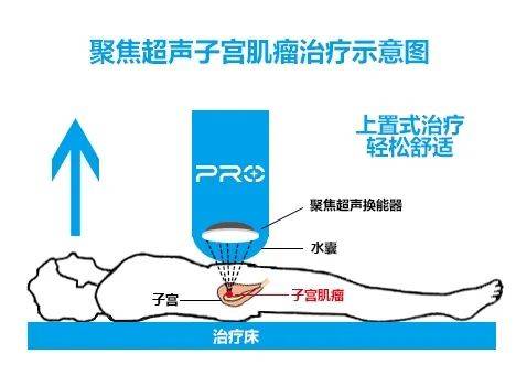 低周保护全面解析，原理、应用与优势一网打尽