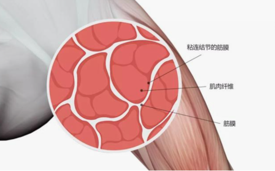 筋膜贴宣传：筋膜视频 