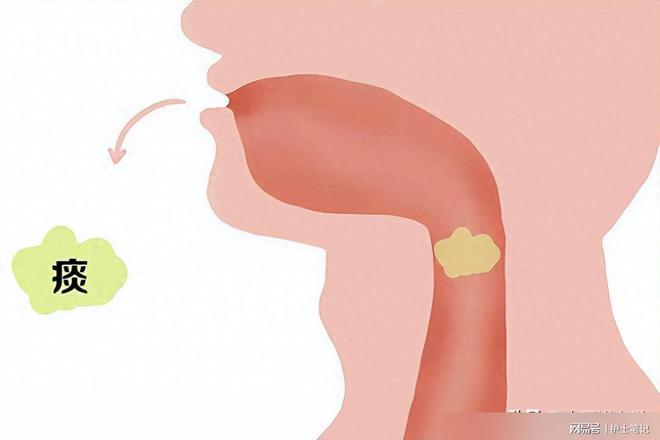 鼻子不断产生痰：鼻子痰多怎么回事 