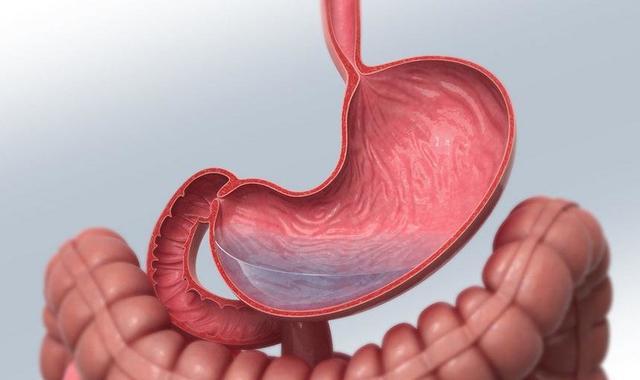 揭秘胃癌突发性背后的真相