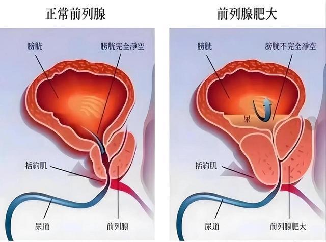 全球男性生殖力排名揭秘，探寻男性生殖奥秘之旅