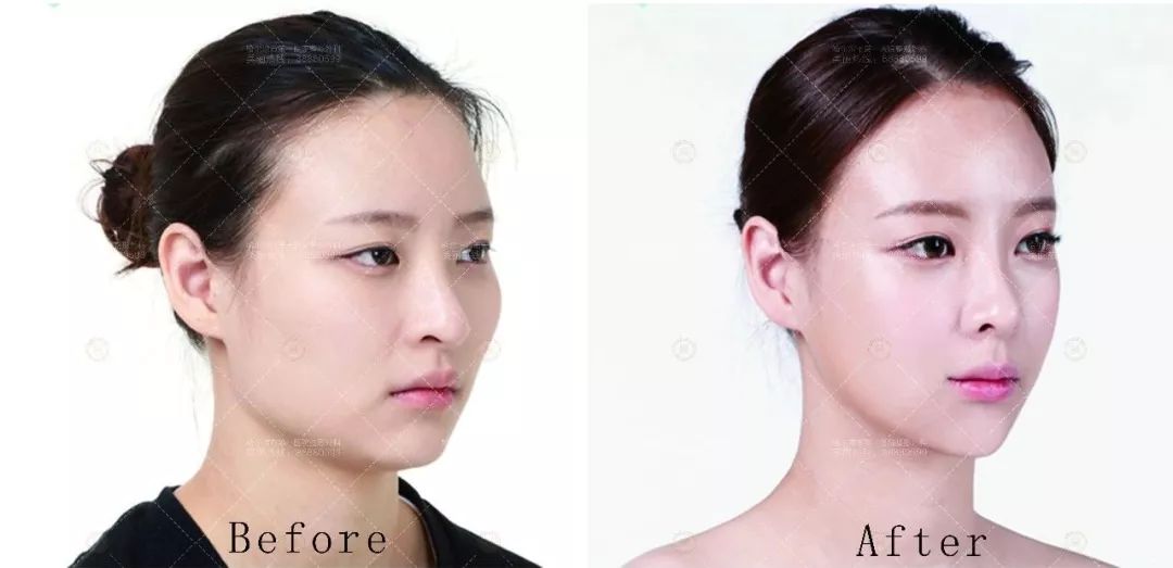 揭秘脸型变化背后的真相，探究脸不断长大的现象起源