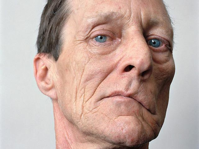 「揭秘面部穴位按摩秘籍，告别面瘫，重塑自信笑容！」