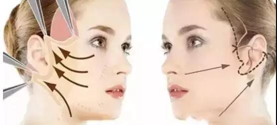 揭秘下颌突发育的形成过程，如何影响面部轮廓？